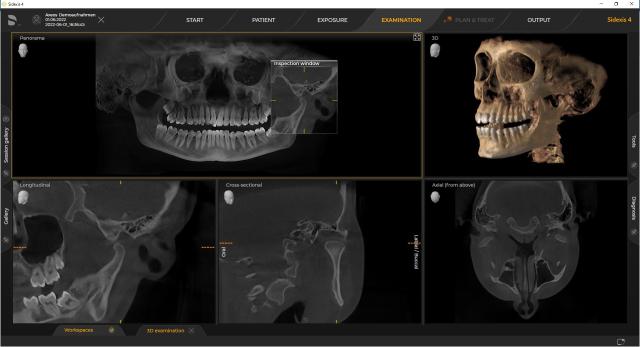 3D diagnosztikai modul licenc